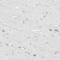 PDLIM3 Antibody, Novus Biologicals:Antibodies:Primary Antibodies