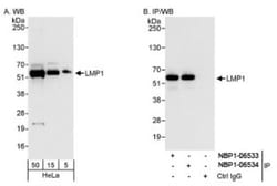 PDLIM7 Antibody, Novus Biologicals 0.1mL; Unlabeled:Antibodies, Polyclonal