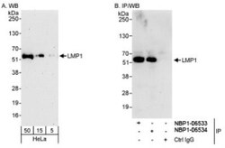 PDLIM7 Antibody, Novus Biologicals 0.1mL; Unlabeled:Antibodies, Polyclonal