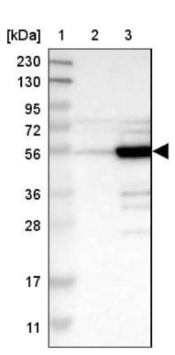 PDLIM7 Antibody, Novus Biologicals:Antibodies:Primary Antibodies