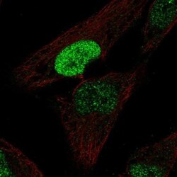 PDX-1/IPF1 Antibody, Novus Biologicals 25 &mu;L, Unlabeled:Antibodies,