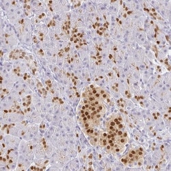 PDX-1/IPF1 Antibody, Novus Biologicals 25 &mu;L, Unlabeled:Antibodies,