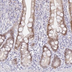 PDX-1/IPF1 Antibody, Novus Biologicals 25 &mu;L, Unlabeled:Antibodies,