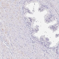 PDX-1/IPF1 Antibody, Novus Biologicals 25 &mu;L, Unlabeled:Antibodies,