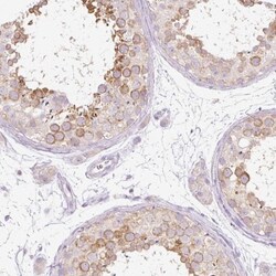 PDXDC1 Antibody, Novus Biologicals 25 &mu;L | Buy Online | Novus Biologicals | Fisher Scientific
