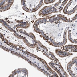 PECI Antibody, Novus Biologicals 0.1 mL | Buy Online | Novus Biologicals | Fisher Scientific