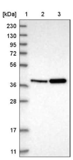 PECI Antibody, Novus Biologicals 0.1 mL | Buy Online | Novus Biologicals | Fisher Scientific