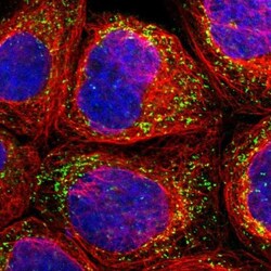 PECR Antibody, Novus Biologicals:Antibodies:Primary Antibodies