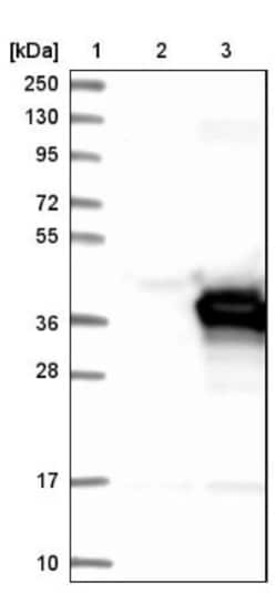 PECR Antibody, Novus Biologicals:Antibodies:Primary Antibodies