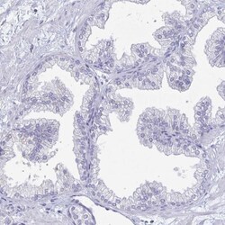 PEG10 Antibody, Novus Biologicals 25 &mu;L, Unlabeled:Antibodies, Polyclonal
