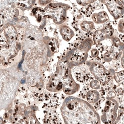 PER3 Antibody, Novus Biologicals 25 μL; Unlabeled:Antibodies, Polyclonal
