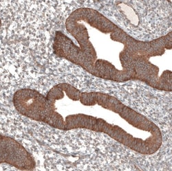 PER3 Antibody, Novus Biologicals 25 μL; Unlabeled:Antibodies, Polyclonal