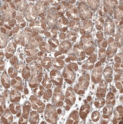 PER3 Antibody, Novus Biologicals 25 μL; Unlabeled:Antibodies, Polyclonal