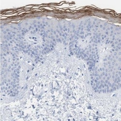 PERP Antibody, Novus Biologicals 25ul | Buy Online | Novus Biologicals | Fisher Scientific
