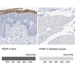 PERP Antibody, Novus Biologicals 25ul | Buy Online | Novus Biologicals | Fisher Scientific
