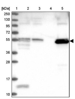 PET112L Antibody, Novus Biologicals:Antibodies:Primary Antibodies