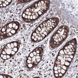 PEX13 Antibody, Novus Biologicals:Antibodies:Primary Antibodies