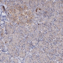 PEX13 Antibody, Novus Biologicals 25 &mu;L; Unlabeled:Antibodies, Polyclonal