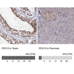 PEX13 Antibody, Novus Biologicals 25 &mu;L; Unlabeled:Antibodies, Polyclonal