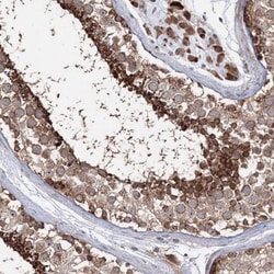 PEX13 Antibody, Novus Biologicals:Antibodies:Primary Antibodies