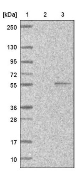 PEX13 Antibody, Novus Biologicals 25 &mu;L; Unlabeled:Antibodies, Polyclonal