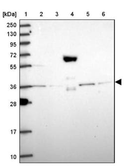 PEX19 Antibody, Novus Biologicals 0.1mL; Unlabeled:Antibodies, Polyclonal