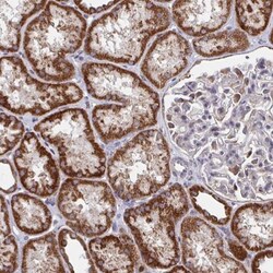 PEX3 Antibody, Novus Biologicals 25 &mu;L, Unlabeled:Antibodies, Polyclonal