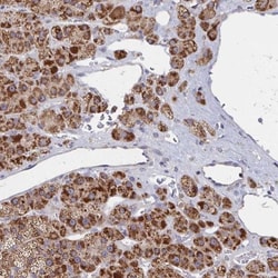 PEX3 Antibody, Novus Biologicals 25 &mu;L, Unlabeled:Antibodies, Polyclonal