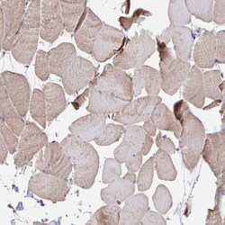 PEX3 Antibody, Novus Biologicals 25 &mu;L, Unlabeled:Antibodies, Polyclonal