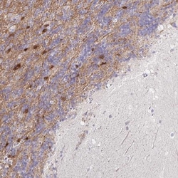 PEX5L Antibody, Novus Biologicals 0.1mL; Unlabeled:Antibodies, Polyclonal