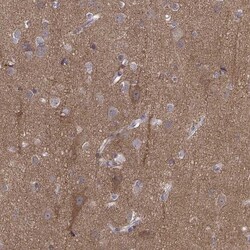 PEX5L Antibody, Novus Biologicals 0.1mL; Unlabeled:Antibodies, Polyclonal