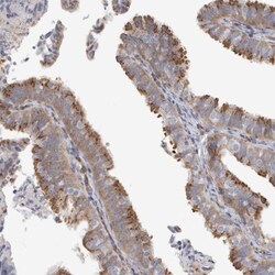 PEX6 Antibody, Novus Biologicals:Antibodies:Primary Antibodies