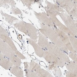 PEX6 Antibody, Novus Biologicals:Antibodies:Primary Antibodies