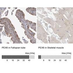 PEX6 Antibody, Novus Biologicals:Antibodies:Primary Antibodies