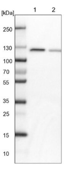 PEX6 Antibody, Novus Biologicals:Antibodies:Primary Antibodies