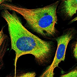 PFDN2 Antibody, Novus Biologicals 0.1mL; Unlabeled:Antibodies, Polyclonal