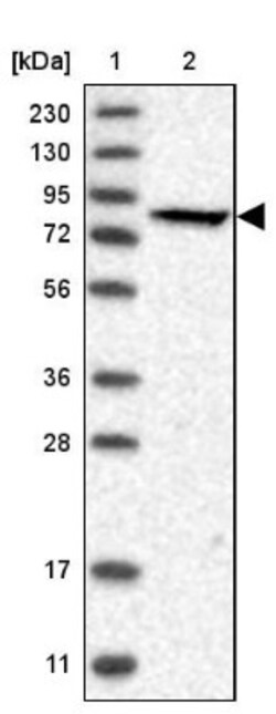 anti-PFKL, Polyclonal, Novus Biologicals 0.1mL; Unlabeled:Antibodies, Polyclonal