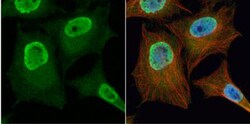 PGAM2 Antibody, Novus Biologicals 0.1mg; Unlabeled:Antibodies, Polyclonal