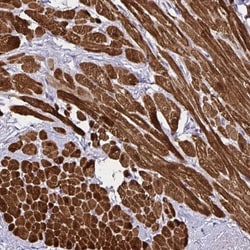 PGAM2 Antibody, Novus Biologicals:Antibodies:Primary Antibodies