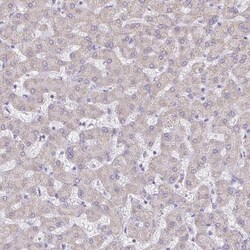 PGAM2 Antibody, Novus Biologicals:Antibodies:Primary Antibodies