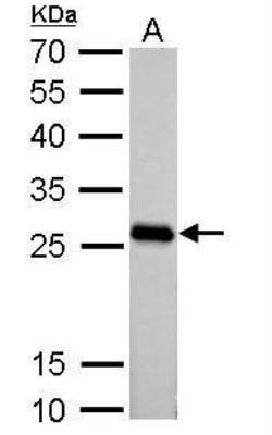 PGAM2 Antibody, Novus Biologicals 0.1mg; Unlabeled:Antibodies, Polyclonal