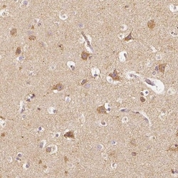 PGAM5 Antibody, Novus Biologicals 0.1mL; Unlabeled:Antibodies, Polyclonal