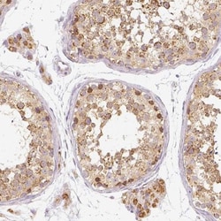 PGAM5 Antibody, Novus Biologicals 0.1mL; Unlabeled:Antibodies, Polyclonal