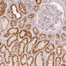 PGAM5 Antibody, Novus Biologicals 0.1mL; Unlabeled:Antibodies, Polyclonal
