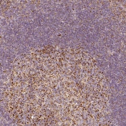 PGAM5 Antibody, Novus Biologicals 0.1mL; Unlabeled:Antibodies, Polyclonal