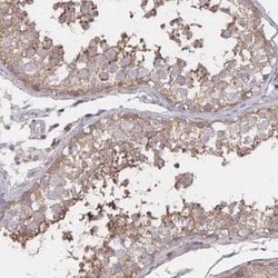 PGAP2 Antibody, Novus Biologicals:Antibodies:Primary Antibodies