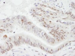 PGC1 alpha Antibody, Novus Biologicals 0.1mL; Unlabeled:Antibodies, Polyclonal