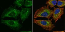 PGD Antibody, Novus Biologicals 0.1mg; Unlabeled:Antibodies, Polyclonal