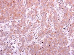 PGD Antibody, Novus Biologicals 0.1 mL | Buy Online | Novus Biologicals | Fisher Scientific