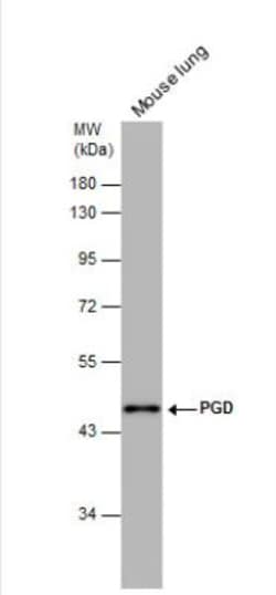 PGD Antibody, Novus Biologicals 0.1mg; Unlabeled:Antibodies, Polyclonal